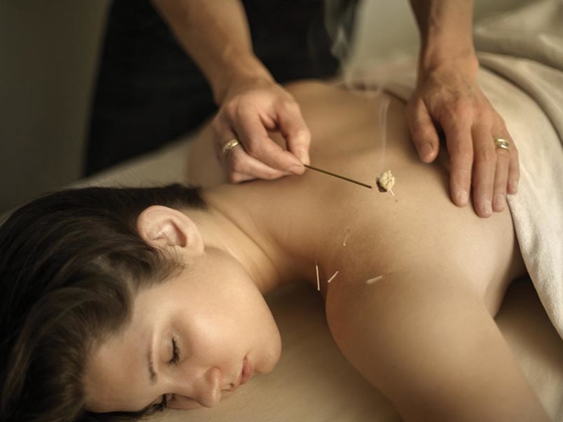 Woman lying in relaxed position receiving acupuncture at Zenergy while acupuncturist uses incense